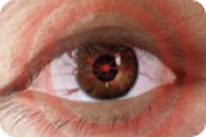 spontaneous orbital pain