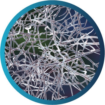 Microscopic view of Nocardia species, commonly presenting with pneumonia, osteomyelitis, and brain abscess.