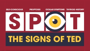 thyroid-eye-disease-mnemonic-thumbnail