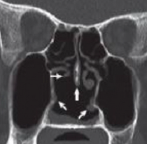 nasal-image