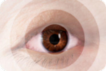 vision loss