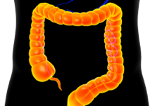 mutation-banner-mobile.png