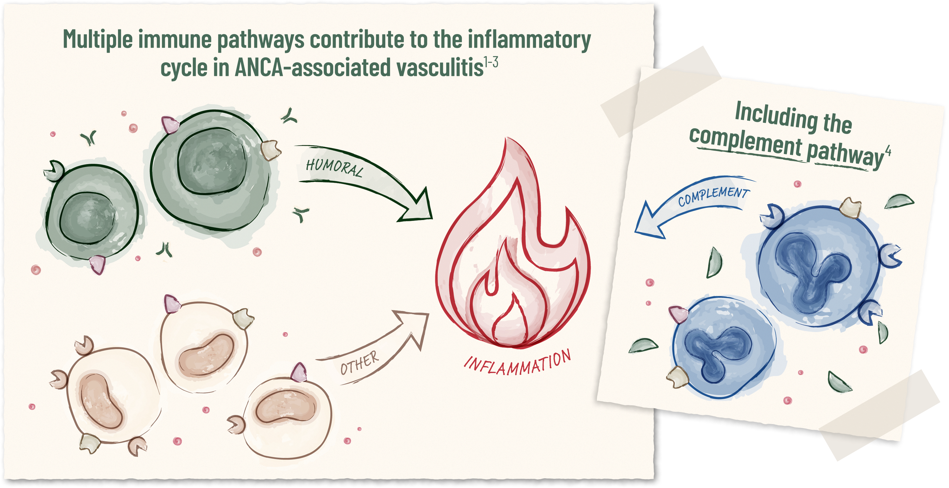 illustration depicting immune pathways involved in inflammation in ANCA-associated vasculitis