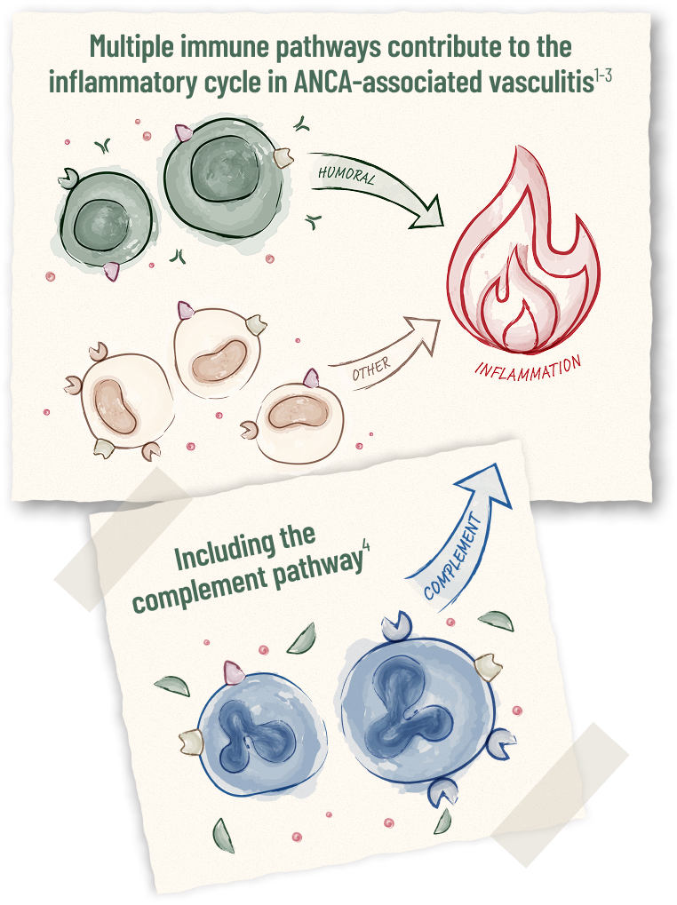 illustration depicting immune pathways involved in inflammation in ANCAassociated vasculitis
