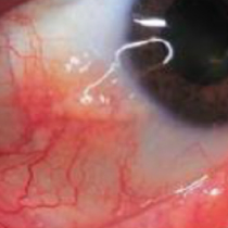 eye-image