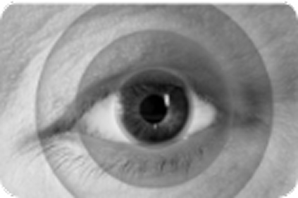 color vision loss