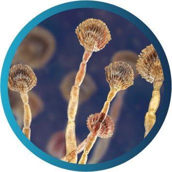 Microscopic view of Aspergillus species, the most common cause of invasive fungal infections including pneumonia, lymphadenitis, osteomyelitis, and brain abscess.
