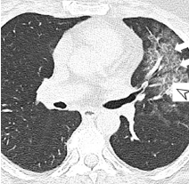 chest-image