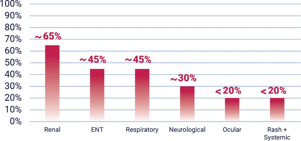 Rarity and Nonspecific Presentation of Severe Active GPA and MPA